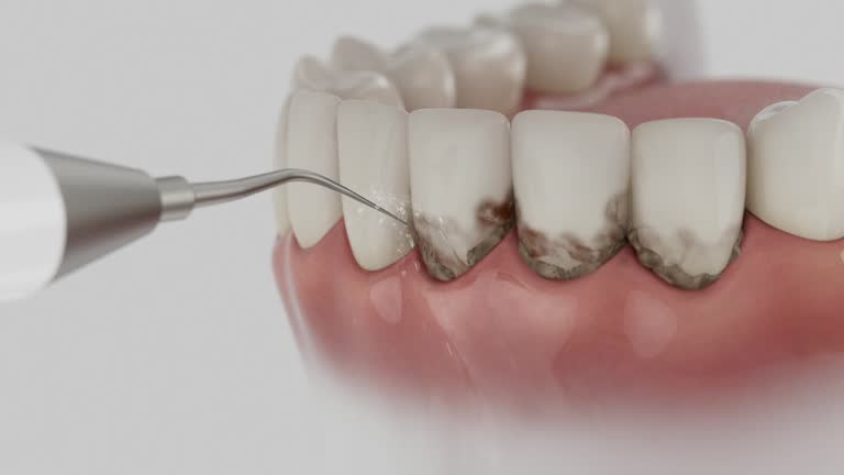 Reliable Wisdom Tooth Removal contractor in Branch County County, MI by Dentist Open Now